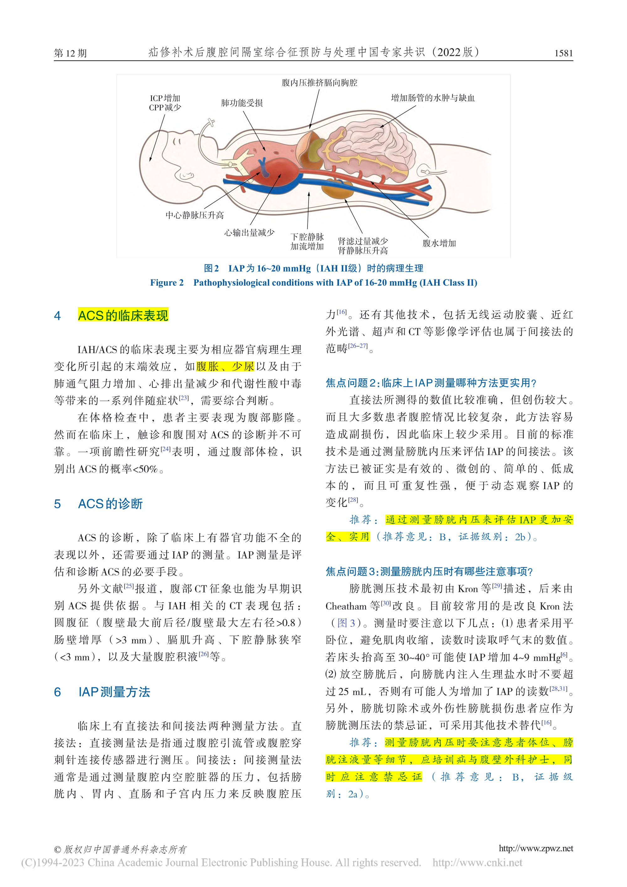 2022-疝修補術后腹腔間隔室綜合征預防與處理中國專家共識-4.jpg